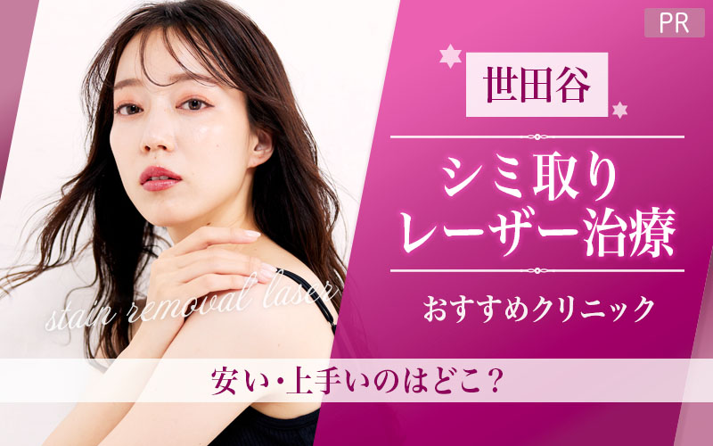 世田谷でシミ取りレーザー治療がおすすめのクリニックは1院！全23店舗から紹介！安い・上手いのはどこ？