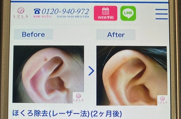 ルラ美容クリニックの症例