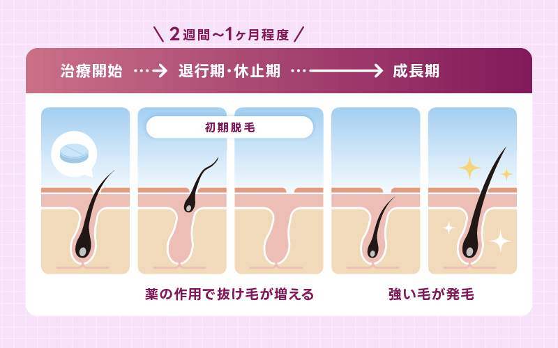 AGA治療 変化の様子