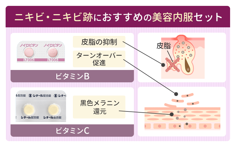 ニキビ・ニキビ跡におすすめの美容内服セット