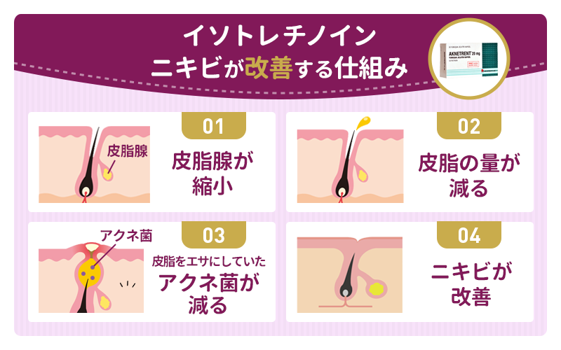 イソトレチノインの作用機序