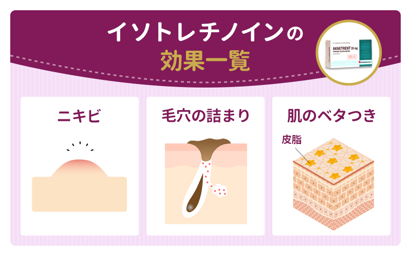 イソトレチノインの効果一覧とニキビが治る仕組みを解説