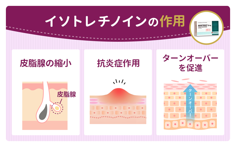 イソトレチノインの作用
