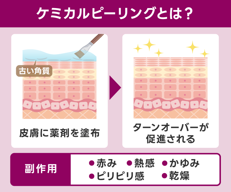 ケミカルピーリングの効果