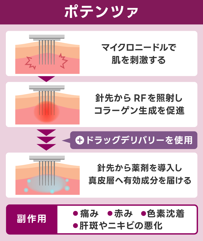ポテンツァとは