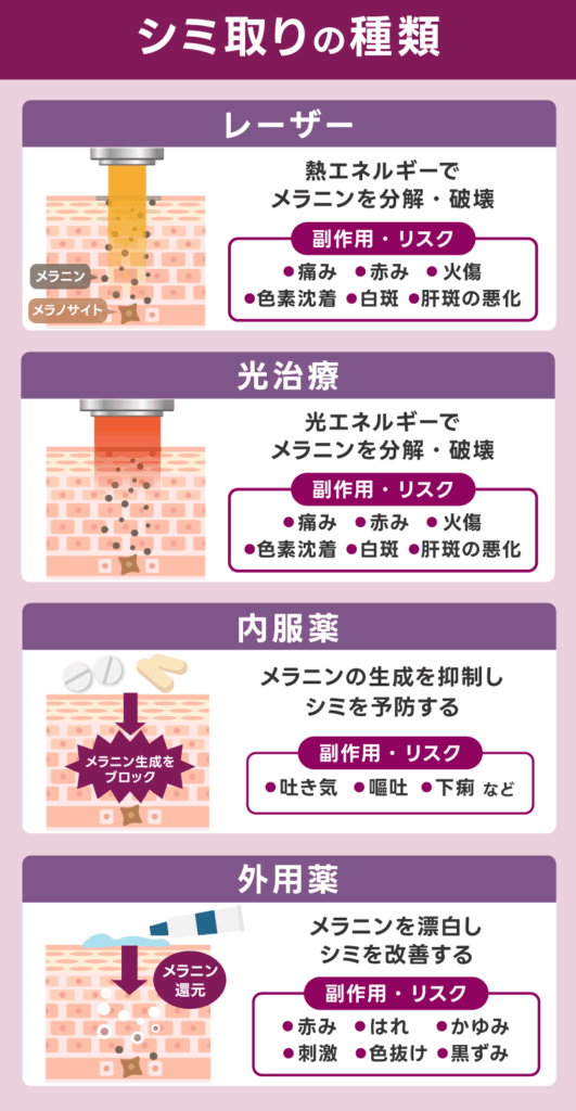 シミ取りの種類と効果