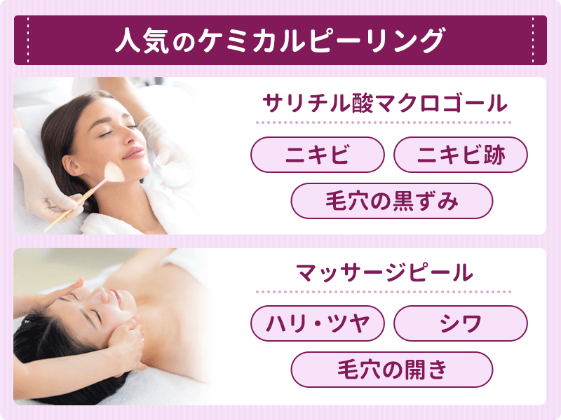人気のケミカルピーリング