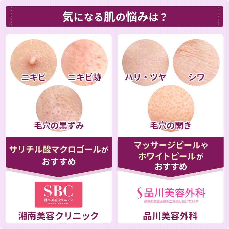 ケミカルピーリングのおすすめクリニック