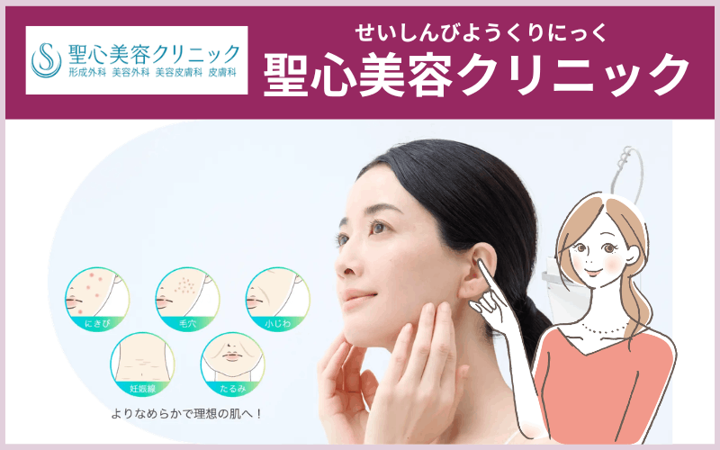 【聖心美容クリニック】ポテンツァではニキビ専用のチップを採用