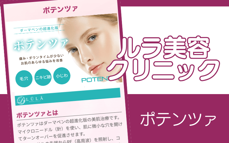 【ルラ美容クリニック】ポテンツァのチップが豊富でさまざまな肌悩みに対応