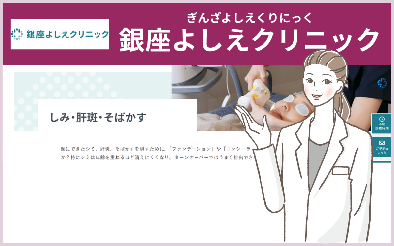 銀座よしえクリニック(東京)のシミ取りレーザー
