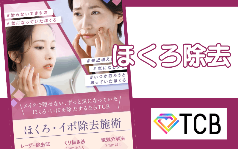 ほくろ除去おすすめクリニックは東京中央美容外科